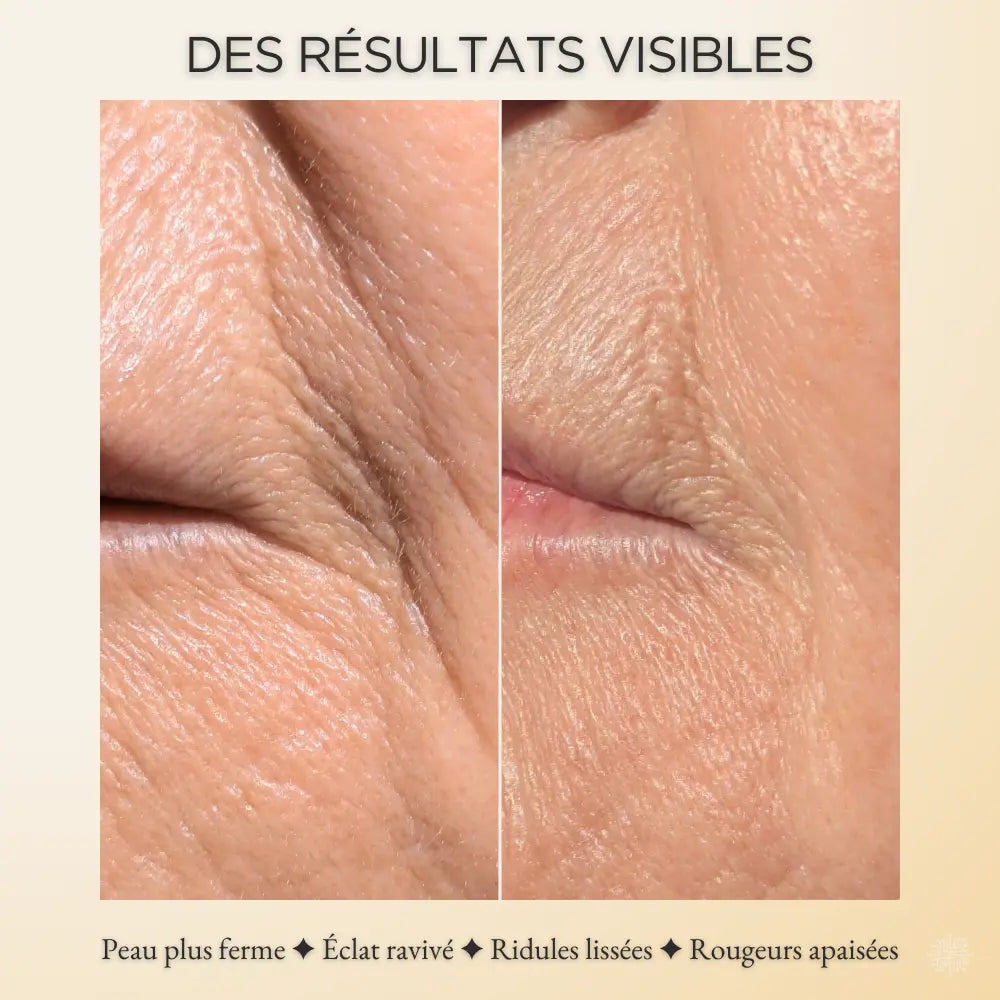 Comparaison avant/après 12 semaines montrant la réduction des ridules, la peau plus lisse et l’éclat amélioré après l’utilisation régulière du masque LED HOLIAĒ.
