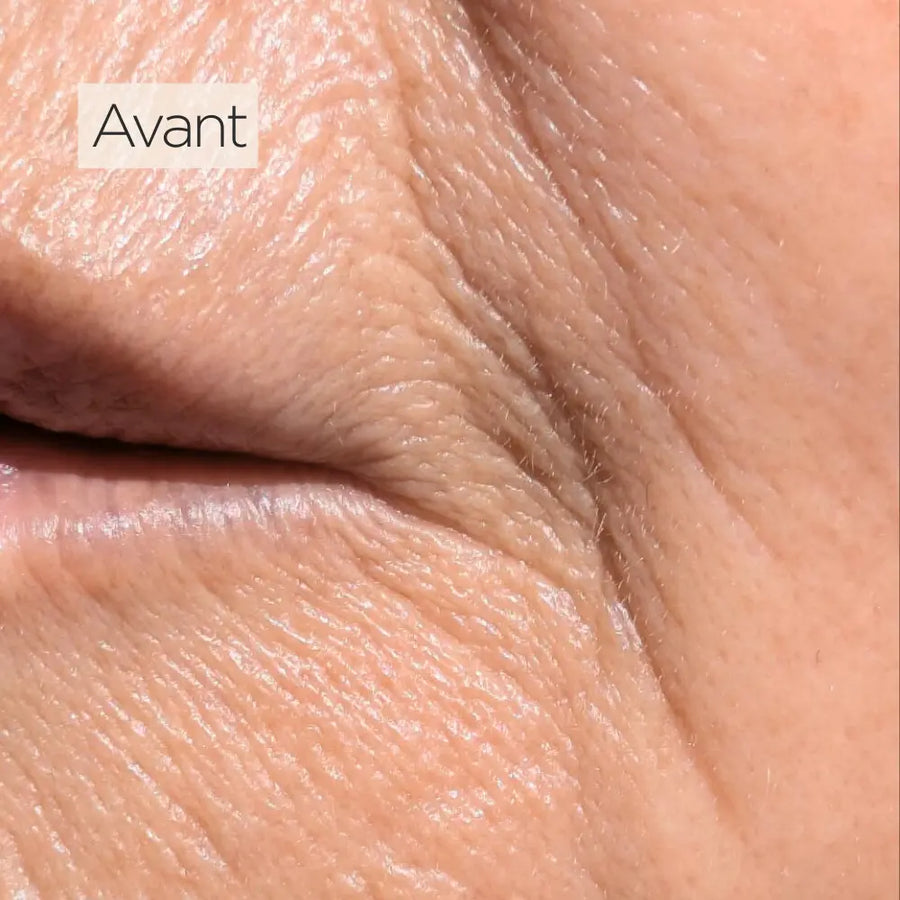 Avant après utilisation du masque LED visage Holiaē RĒ:GEN I montrant une peau plus lisse, rides adoucies et grain affiné après 4 semaines d’utilisation.