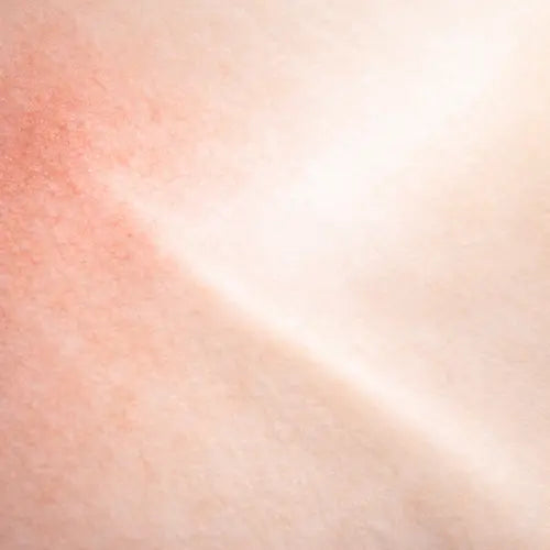 Texture de peau avec rougeurs diffuses représentant l’action d’un masque LED visage lumière jaune 590 nm sur la microcirculation et l’uniformité du teint.