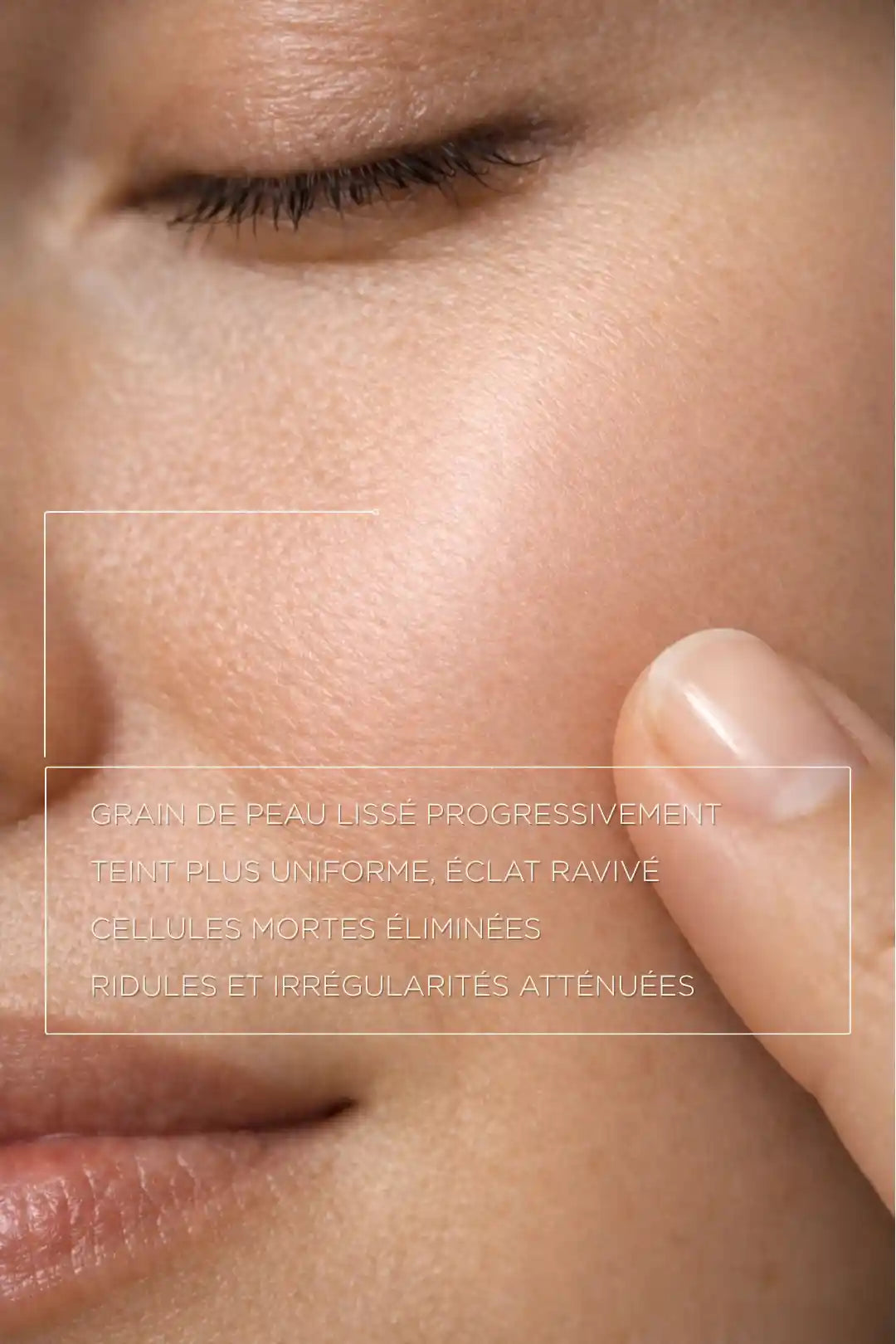 Résultat peeling AHA grain de peau lissé teint uniforme éclat ravivé