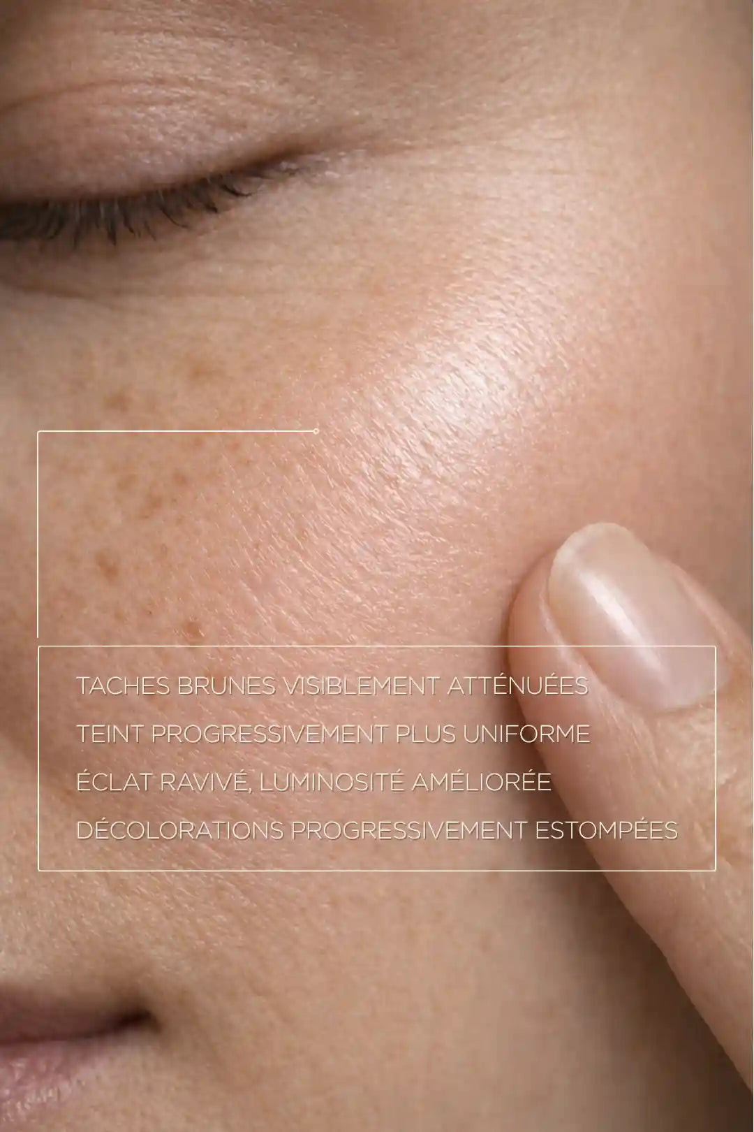 Résultat sérum acide kojique sur peau avec taches pigmentaires atténuées et teint plus uniforme